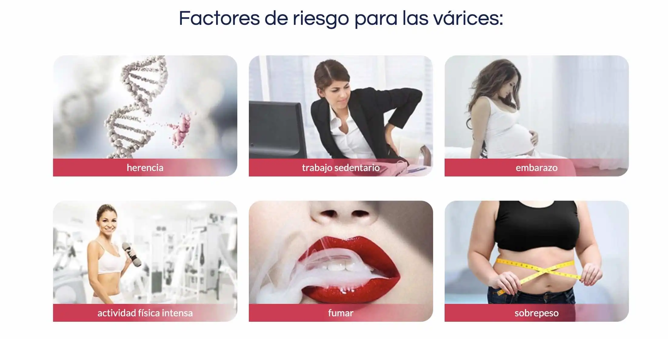 factores de riesgo para las varices